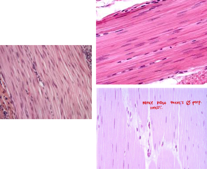 <p><strong>Smooth muscle tissue</strong></p>