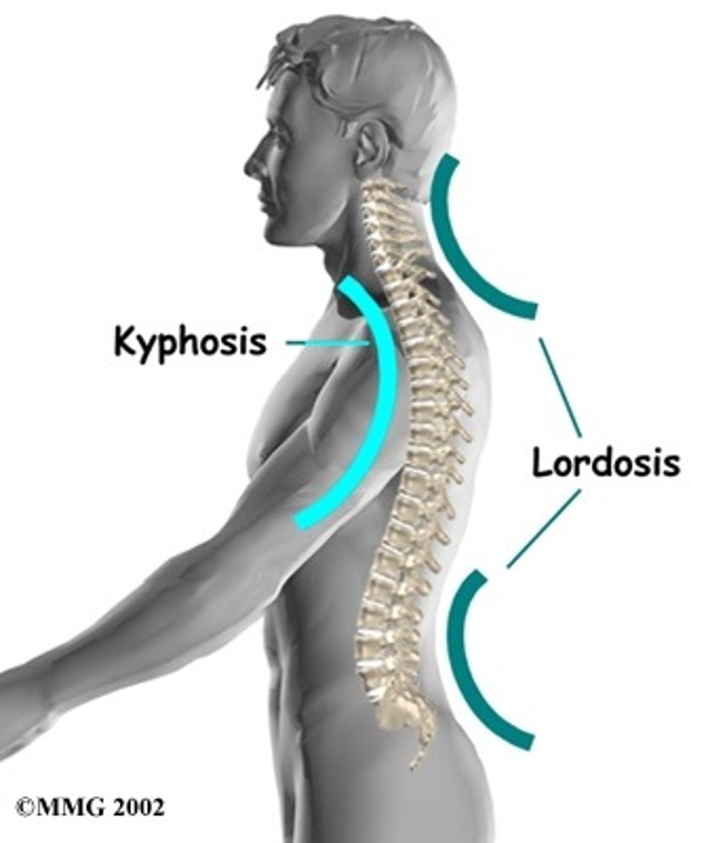 <p>thoracic spine is too straight, loss of natural curve</p>