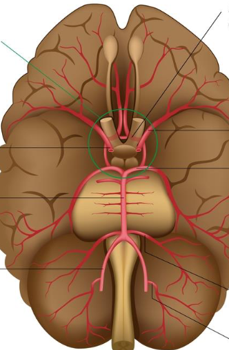<p>What does the green circle represent in this brain?</p>