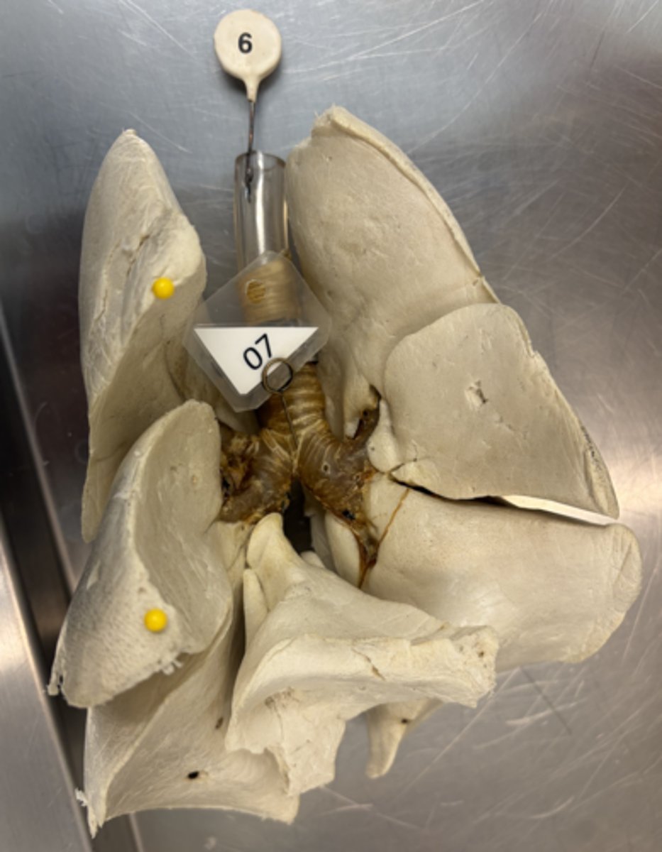 <p>a. Identify the incisure between the yellow pins.</p><p>b. Which border of which portions of the lungs create the incisure from "A"?</p>