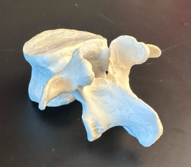 <p>What is this bone?</p>