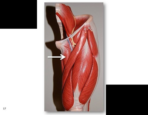 <p>What muscle is this?****</p>