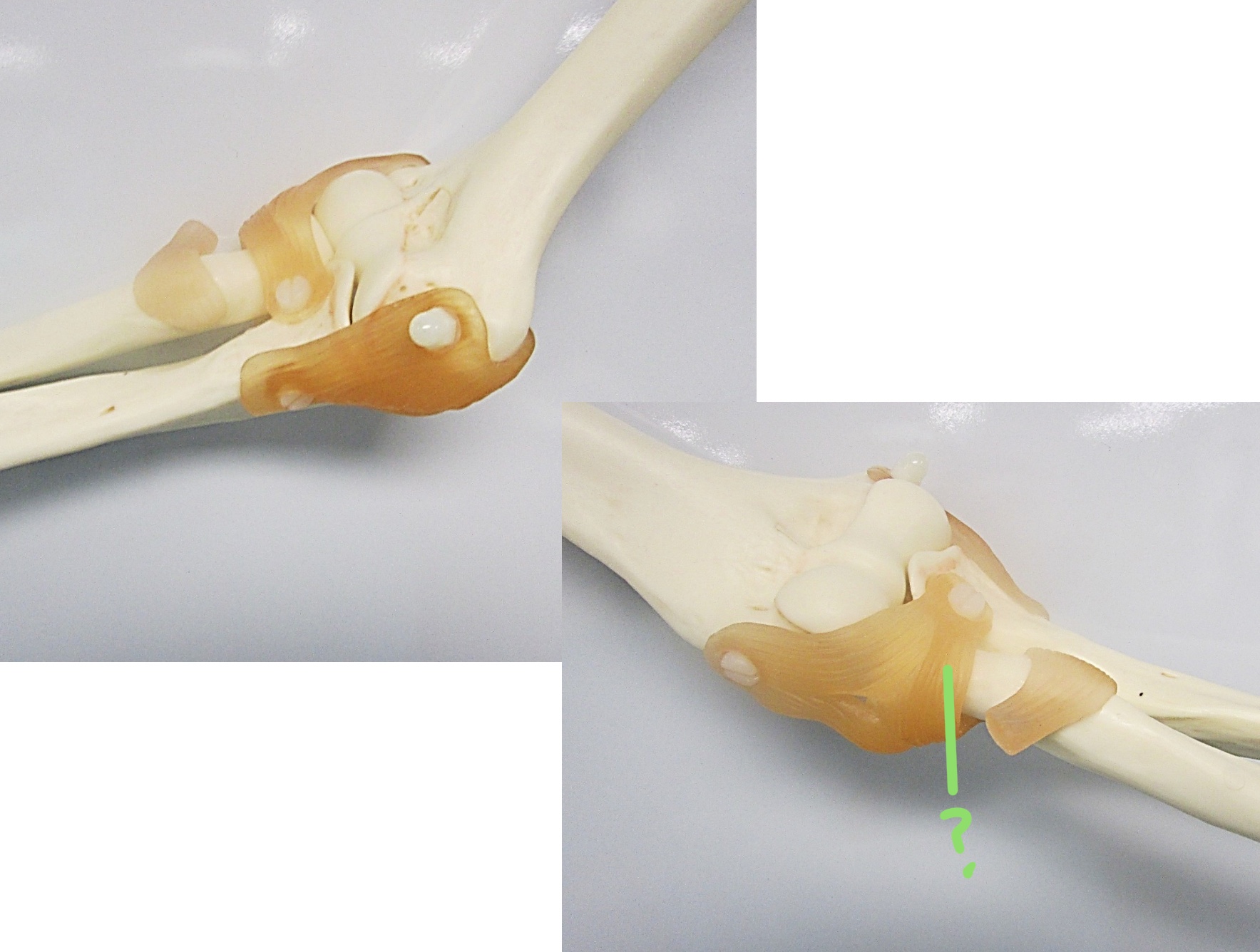 <p>Determine the part of the joint highlighted</p>