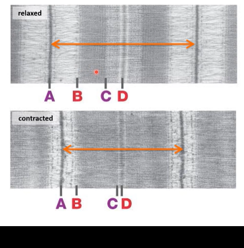 <p>What area of the sarcomere decreases in length during contraction?</p><p><br>A-B</p><p>B-C</p><p>C-D</p>