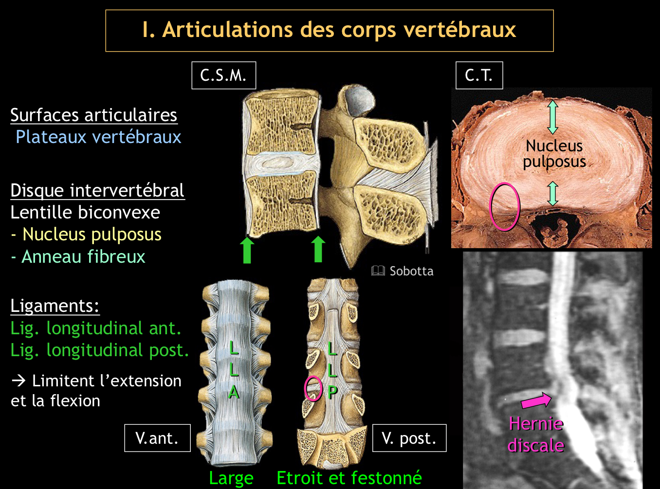 <p>Sur la face postérieure des corps vertébraux, dans le canal vertébral</p>
