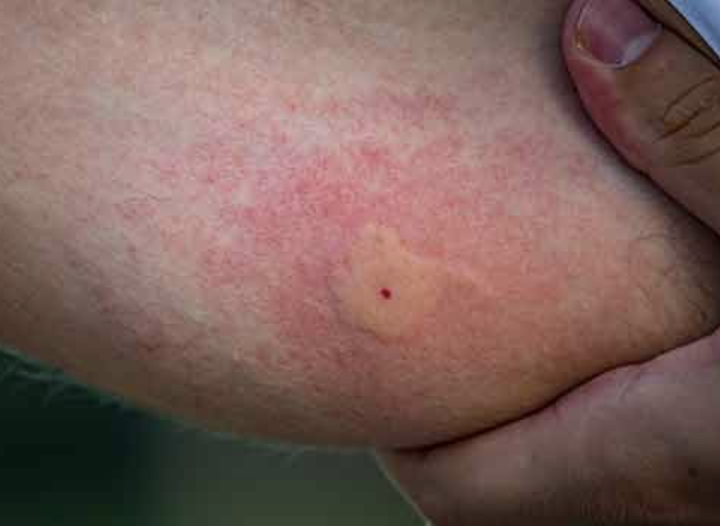 <p>found in humid or warm climates </p><ul><li><p>can transmit malaria or West nile virus</p></li></ul><p></p>