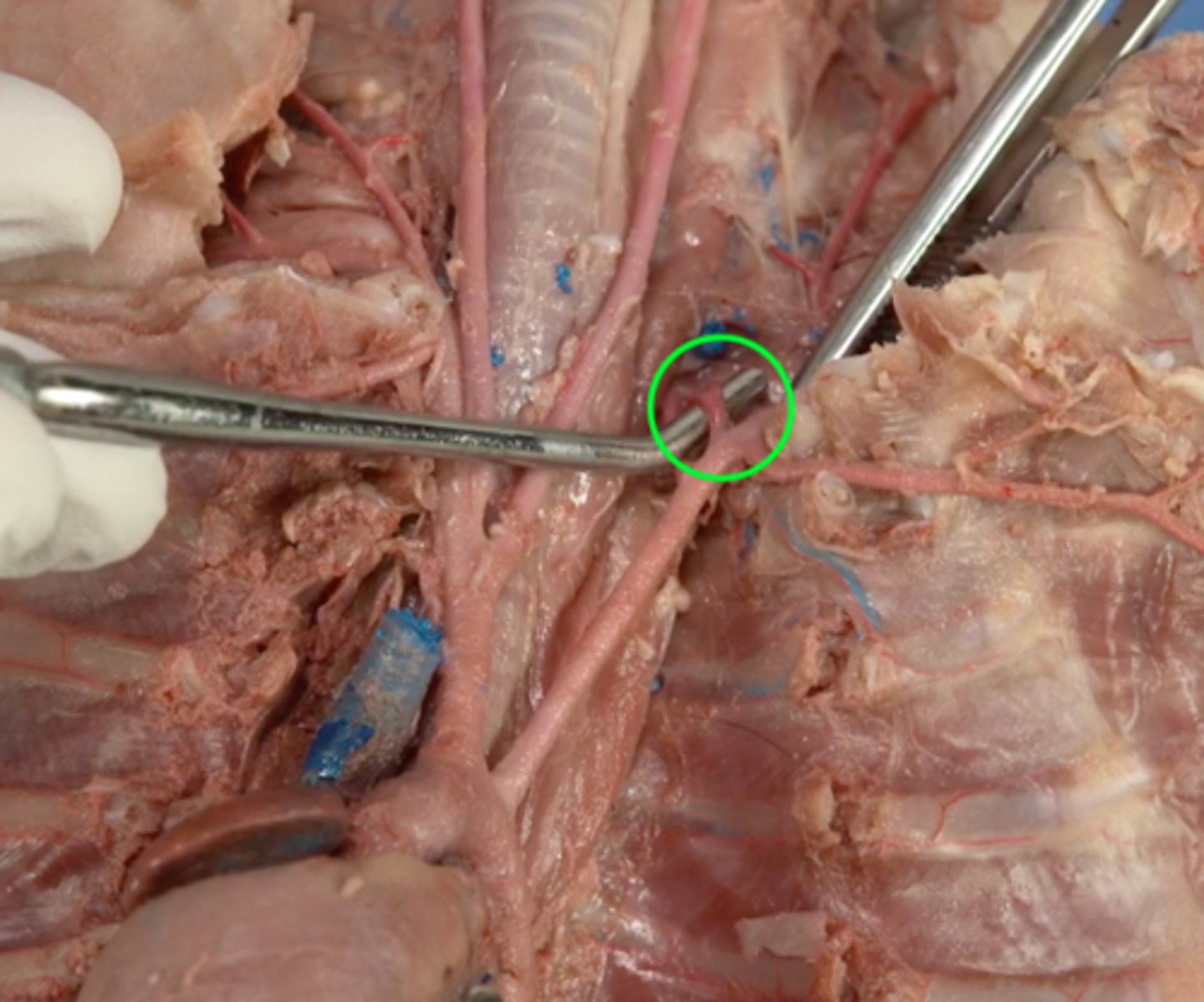 <p>3rd branch of the subclavian artery; supplies upper extremities</p>