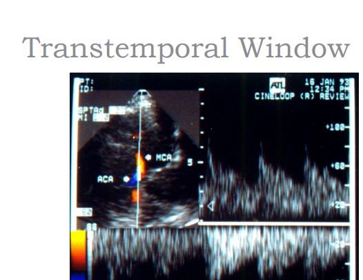 <p>what is this an image of </p>