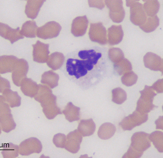 <p>blue in cytoplasm&nbsp;</p>