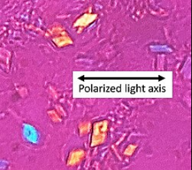 <p>What disease causes this</p>