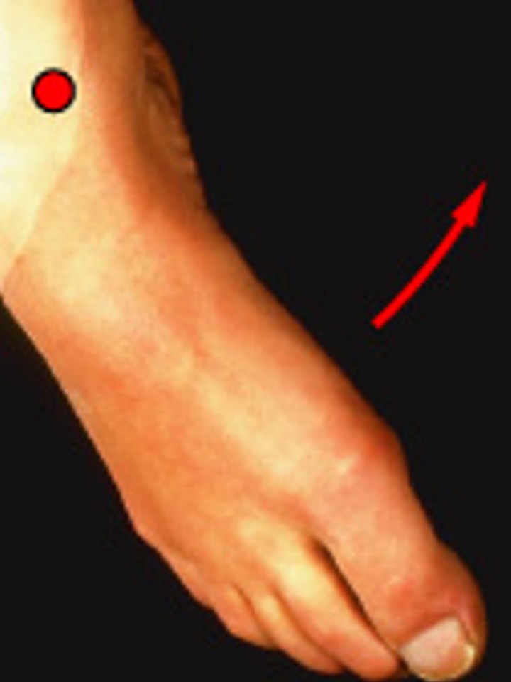 <p>Which special movement is:</p><ul><li><p>Twists sole of foot medially (inward)</p></li></ul><p></p>