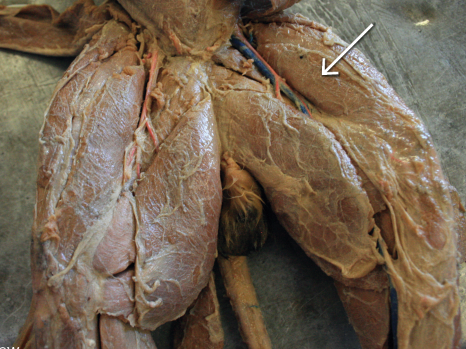 <p>anterior view</p>