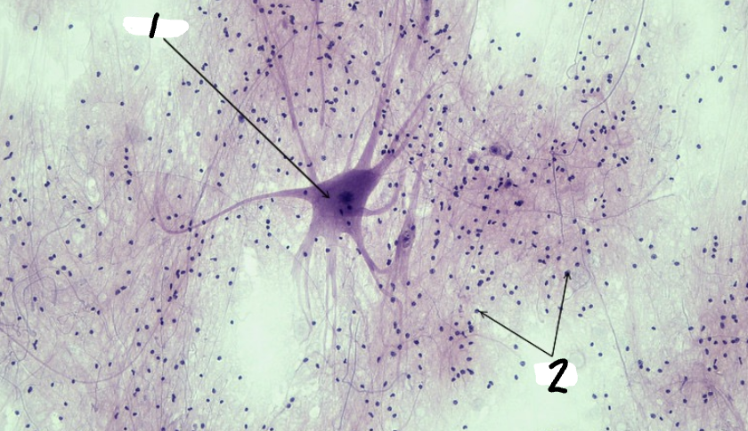 <p>Label the image</p>