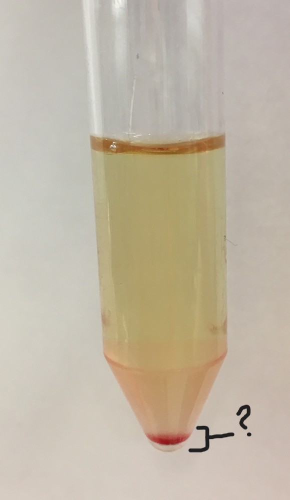 <p>What is this section of this centrifuged urine sample?</p>