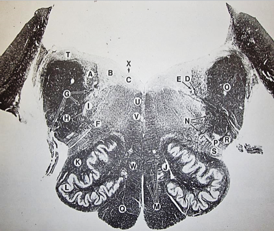 <p>K</p>