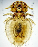 <p>What Parasite Is This?</p>