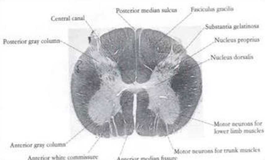 <p>De qué región medular  es este corte?</p>