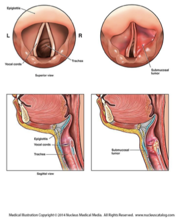 <p></p><p>Larynx – houses the vocal cords.  </p><p>There are two folded structures of the vocal cords.  </p><p>When you breathe normally there is a large gap between the cords.  </p><p>When you speak, muscles contract bringing cords closer.  The air that passes through them vibrates the cords producing sound.</p><p></p>