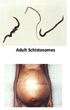 <p>Disease: rash, hepatic scarring that causes obstruction of blood flow and build up of fluid in the abdominal cavity</p><p>Treatment: drugs</p>