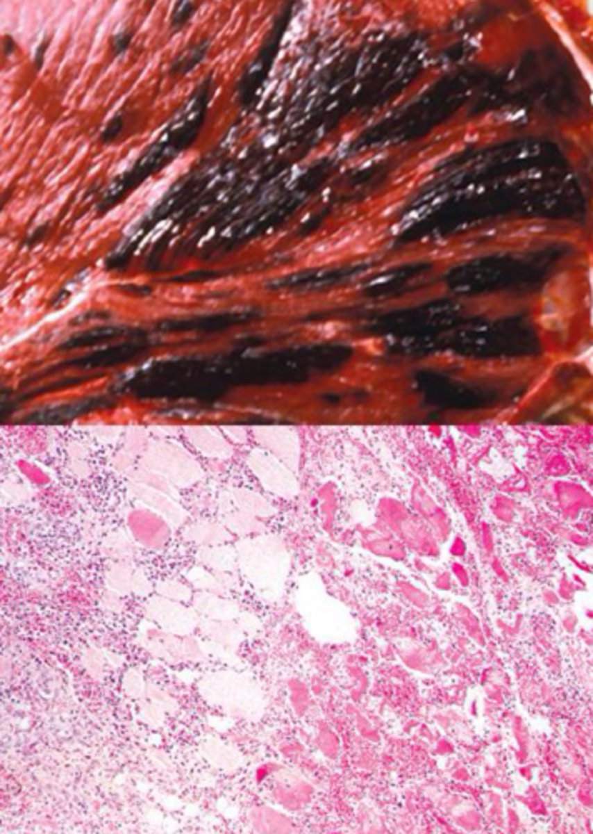 <p>Identify the pathology?</p>