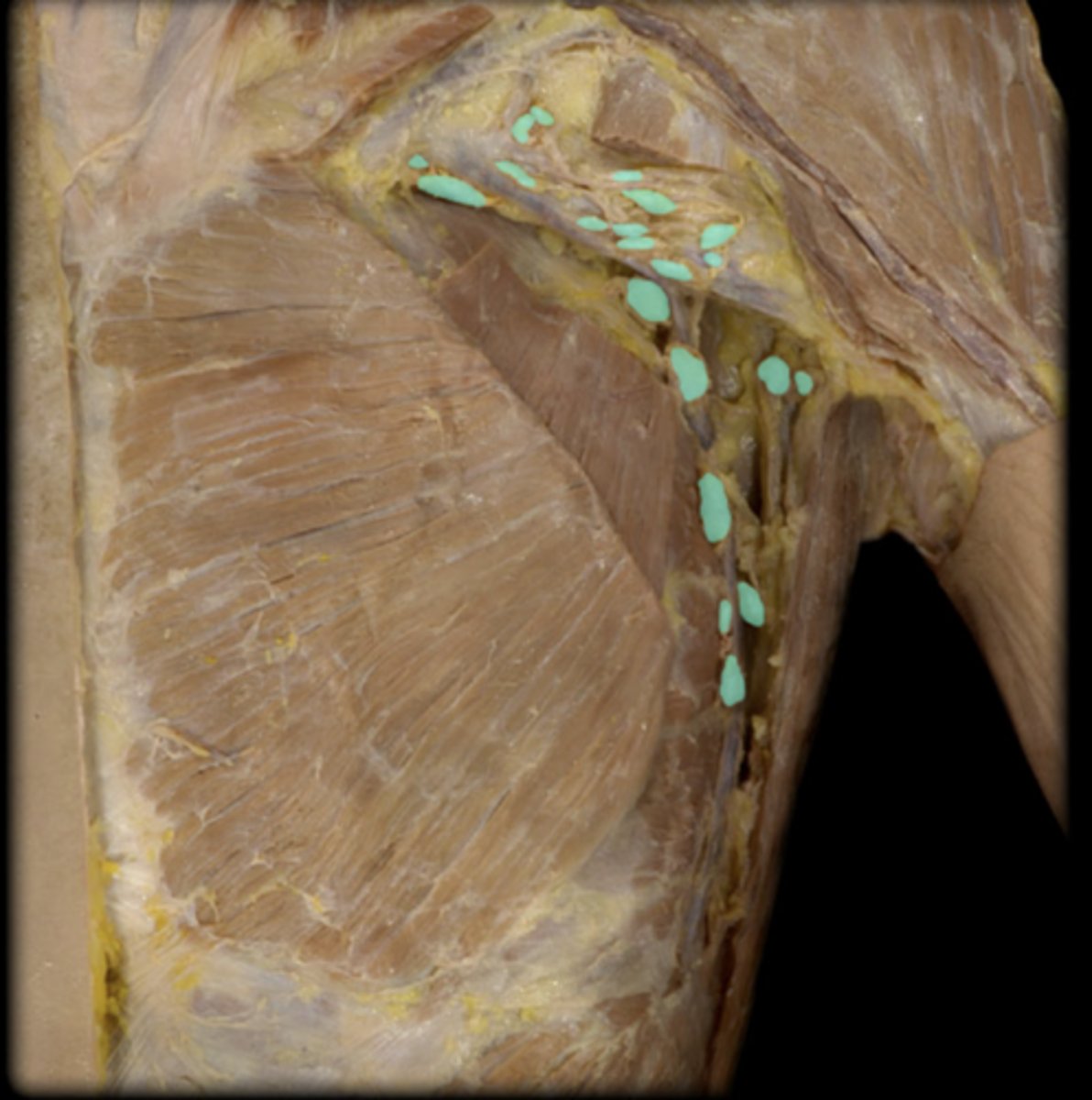 <p>What lymphatic structure is highlighted in this image?</p>