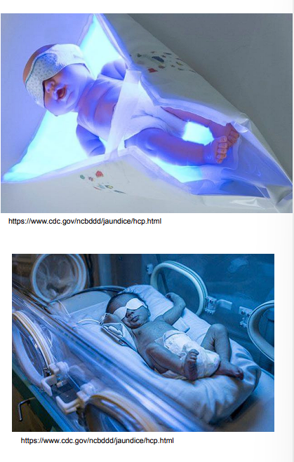 ● Helps break down bilirubin so it may  be excreted in the feces.  

● Must ensure the eyes and genitals are  covered.  

● Monitor the level and distance from  the light if overhead therapy being  used.  

● Double, triple, and quadruple therapy  depending on severity. 