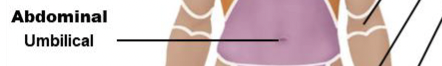 <p>abdomen/umbilical</p>
