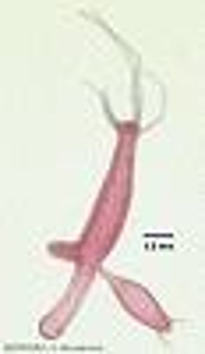 <p>A form of asexual reproduction seen in organisms like Hydra and Sponge.</p>