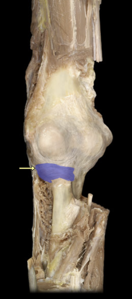 <p>what ligament is this?</p>