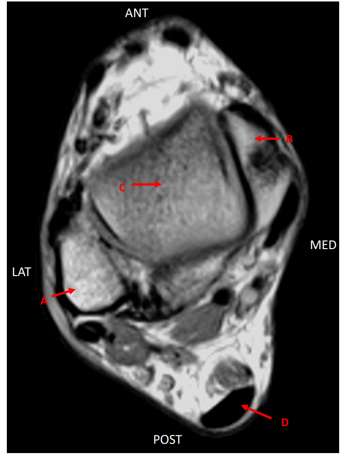 <p>C</p>