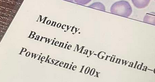<p>fagocytują, prezentują antygeny, przekształcają się w makrofagi, posiadają zwiąkzi ułatwiające fagocytozę(peroksydaza, hydrolazy kwaśne)</p>