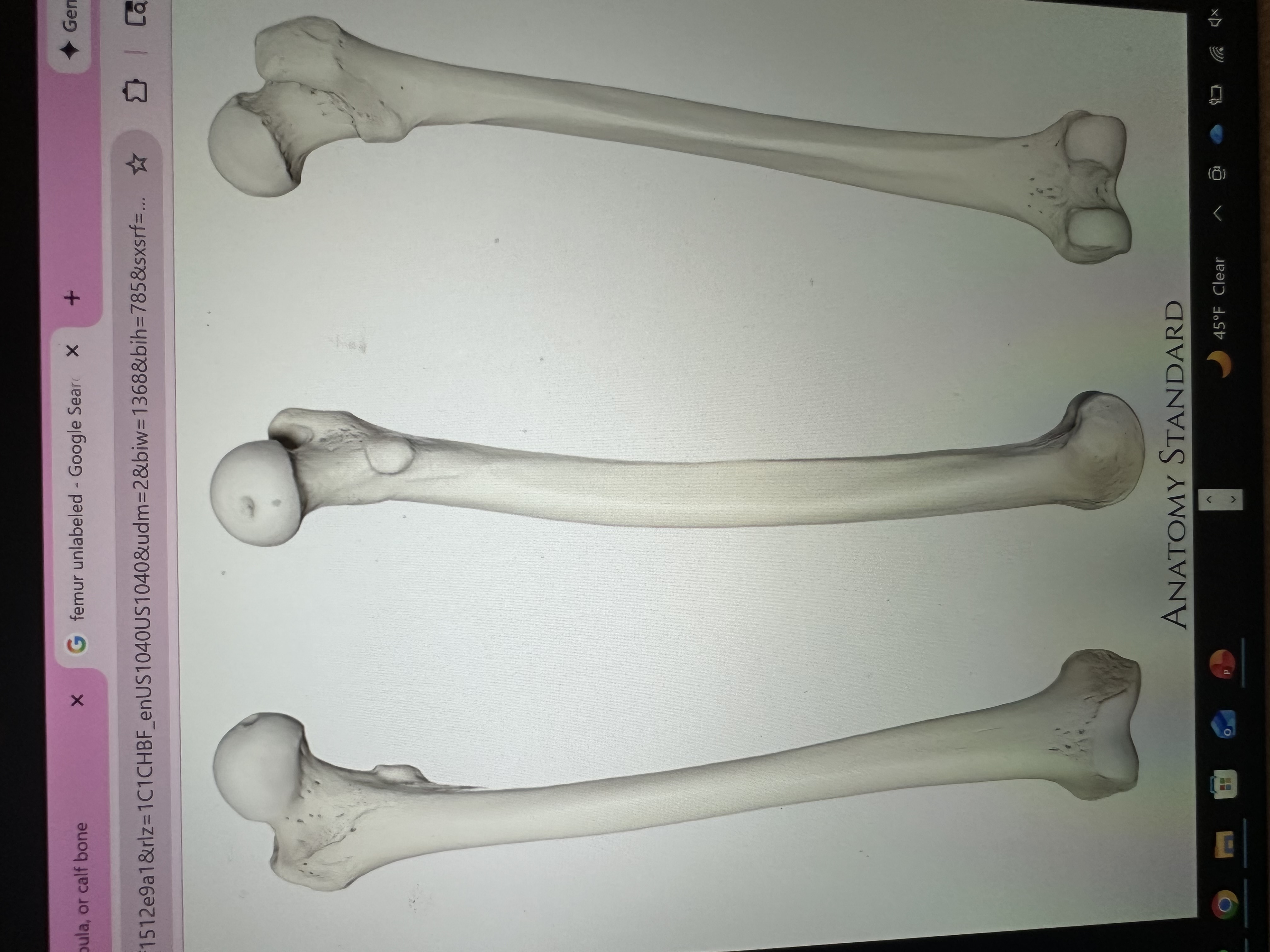 <p>what is this bone</p>