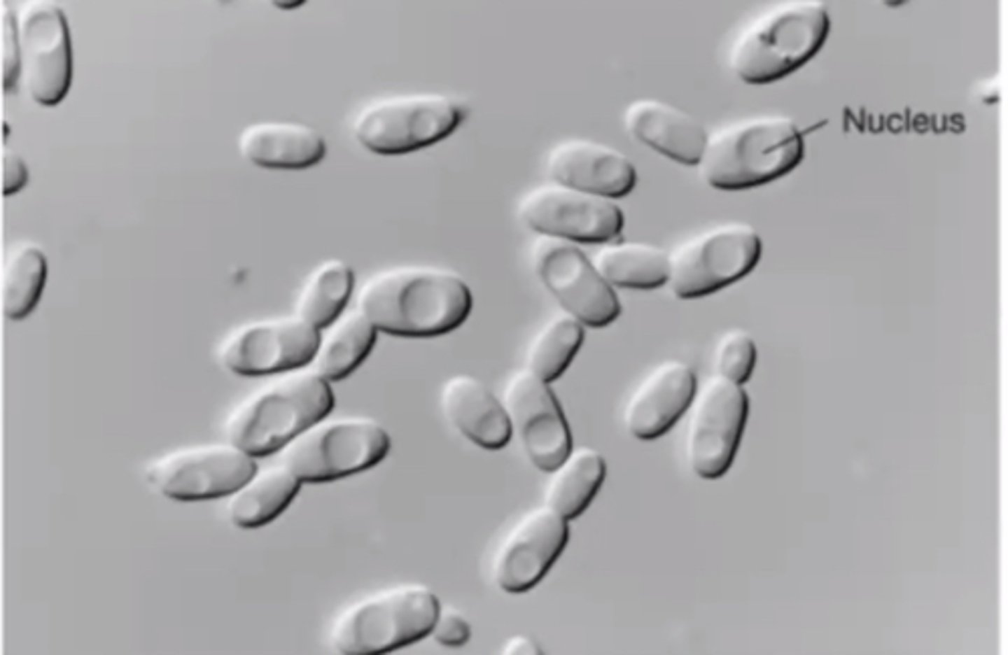 <p>What type of microscopy is shown?</p>