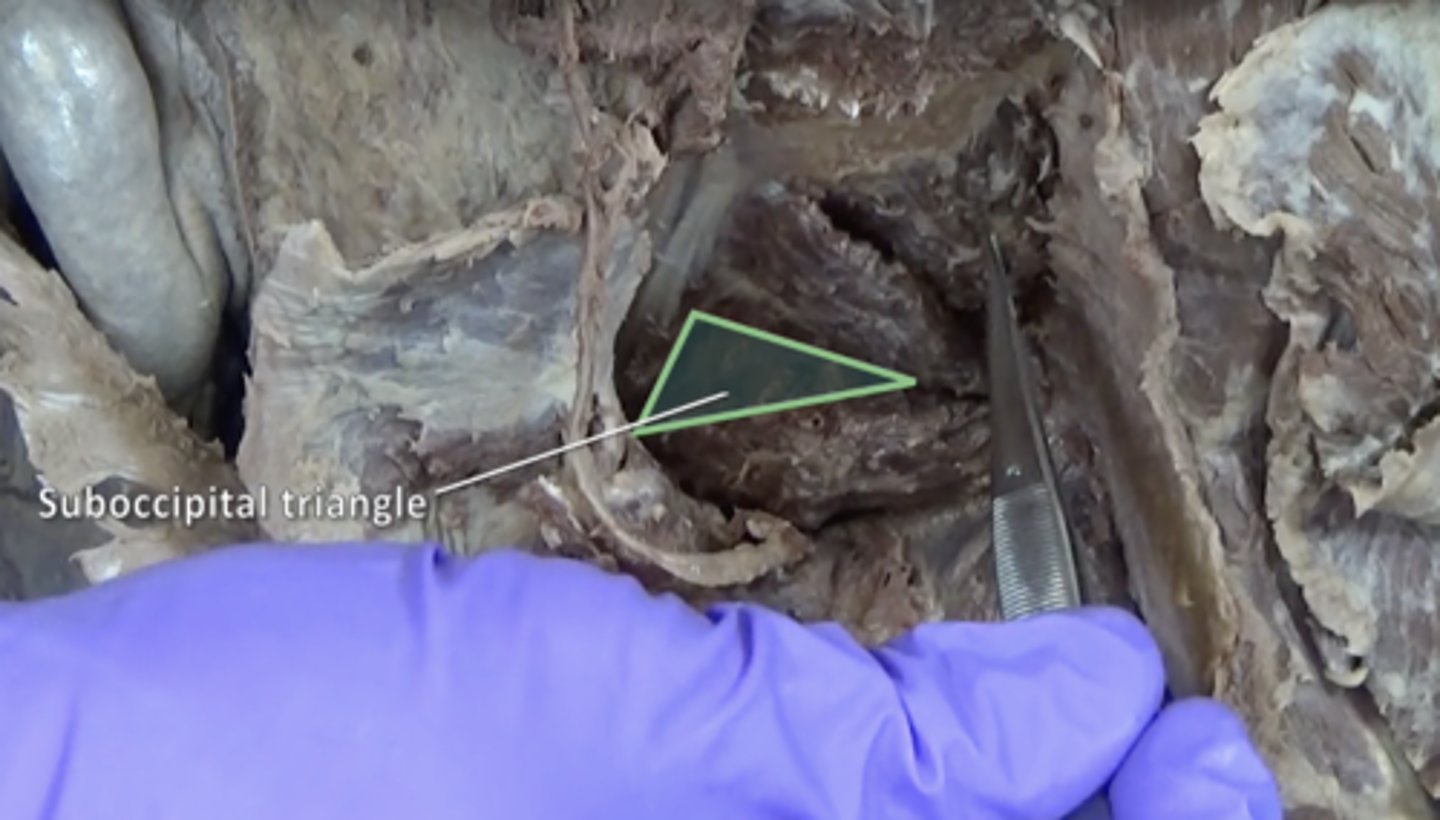<p>Rectus capitis posterior major, Obliquus capitis superior, Obliquus capitis inferior</p>