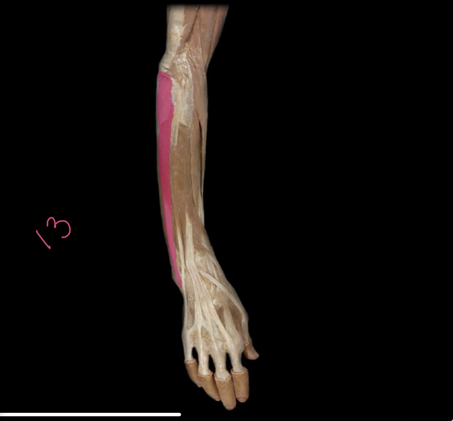 <p>Extensor carpi ulnaris</p>