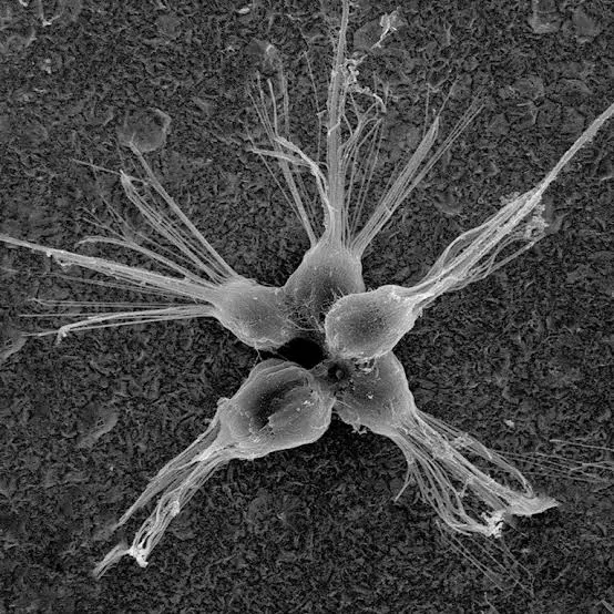 <p>Which protist is this?</p>