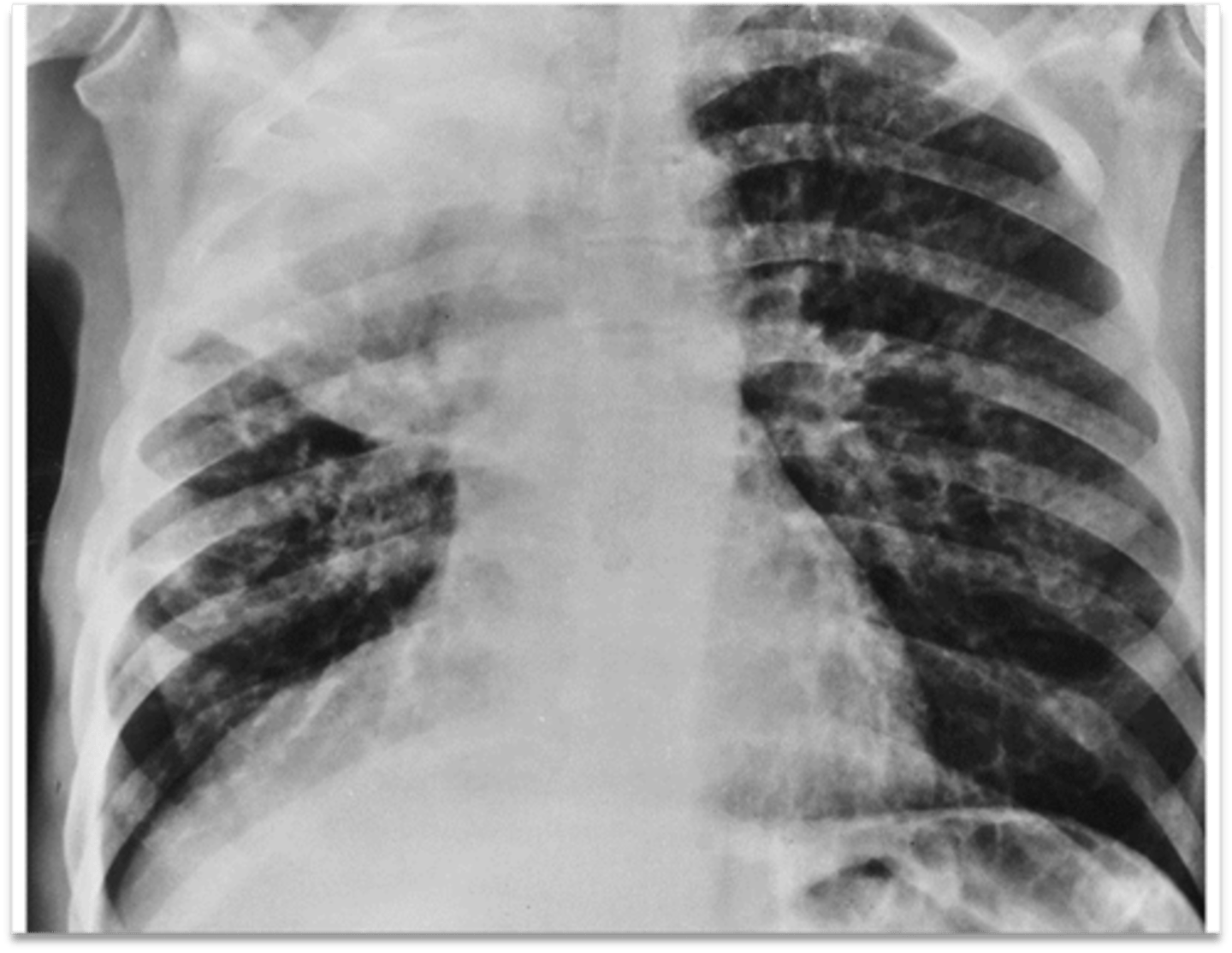 <p>Interpretation?</p>