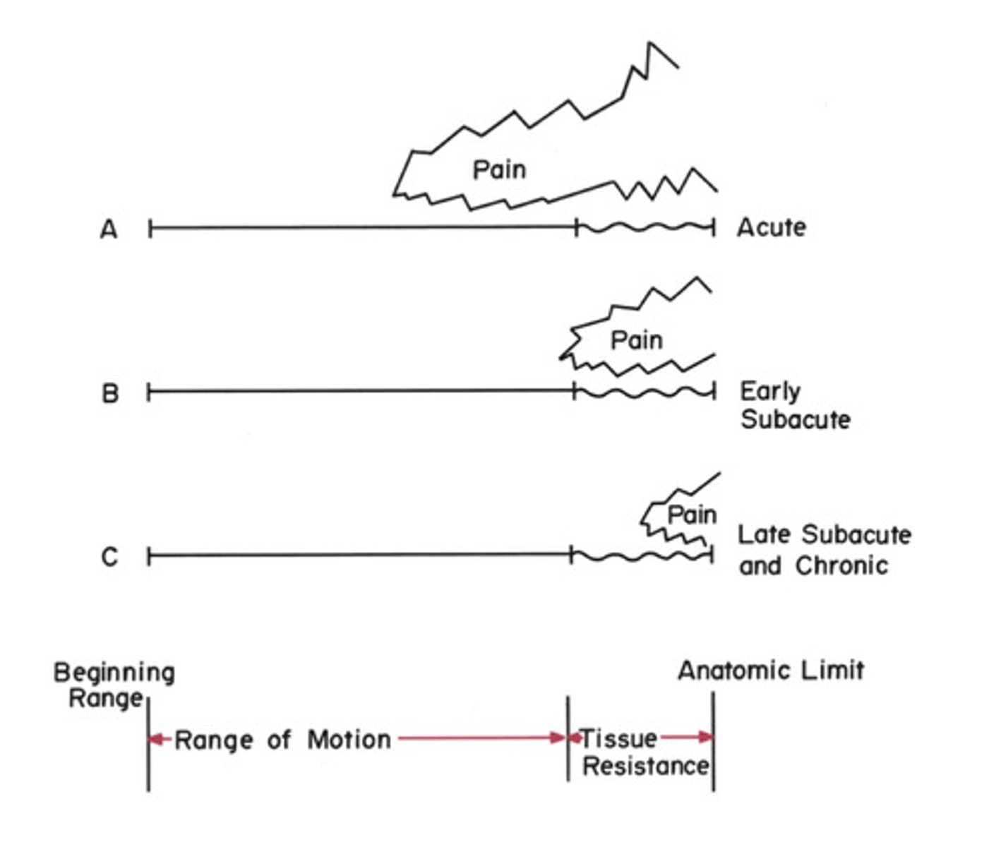 <p>refers to a tissue's tolerance to lengthened positions; depending on acuity of injury, a tissue may exhibit differences in stretch tolerance</p><p>-earlier onset of pain= more severe</p><p>-later onset of pain= less severe</p>