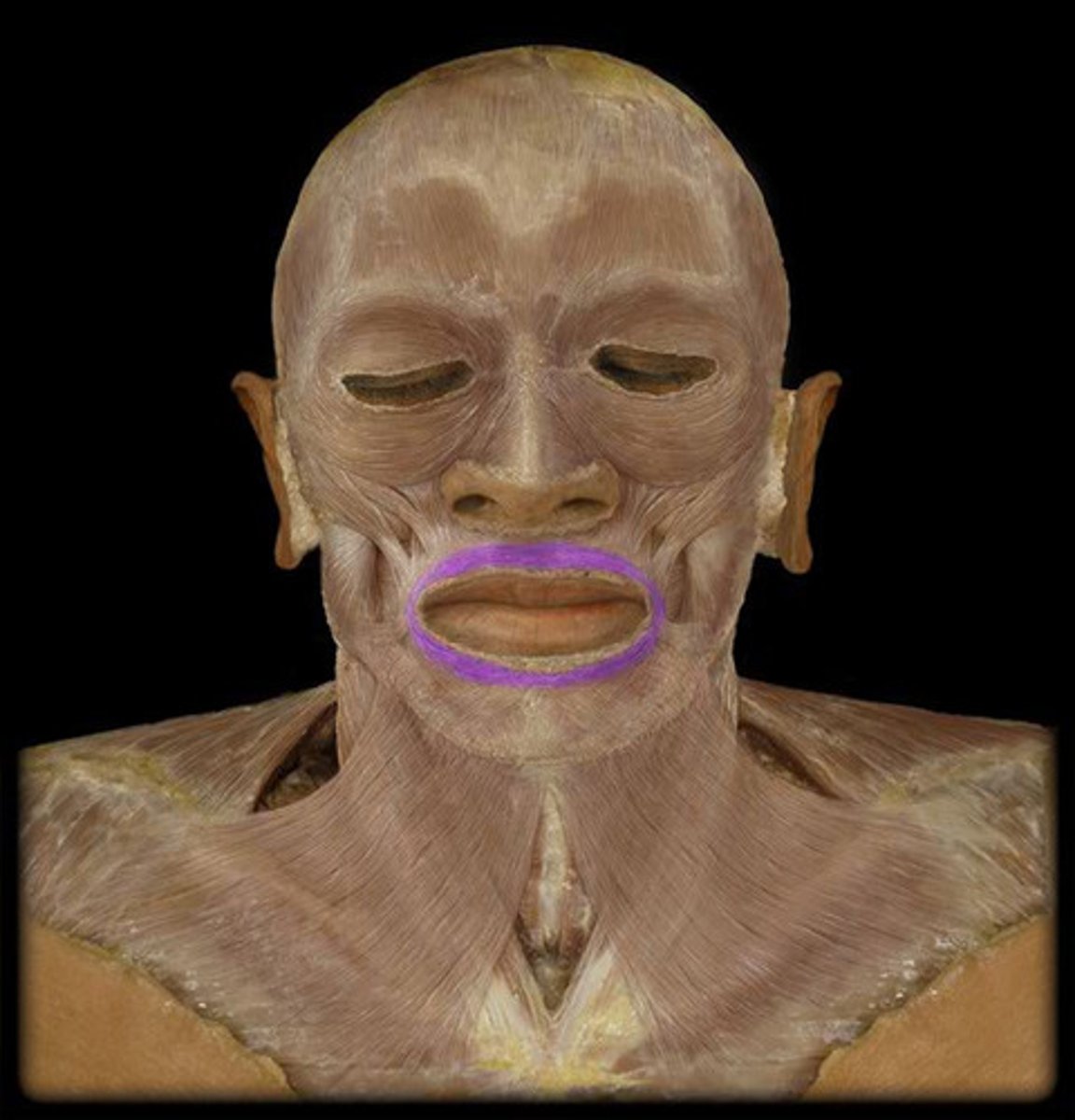 <p>Name the muscle</p>