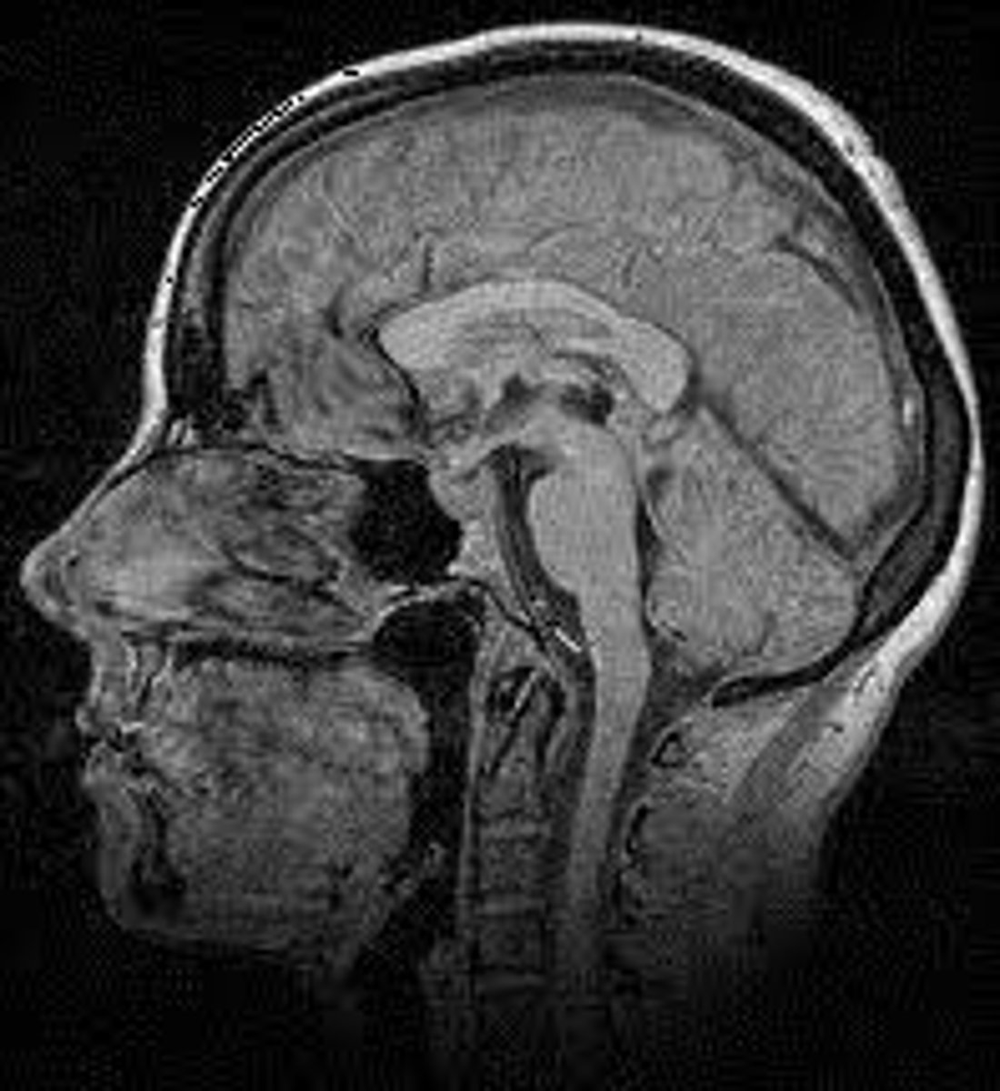 <p>ID the plane of view:</p>