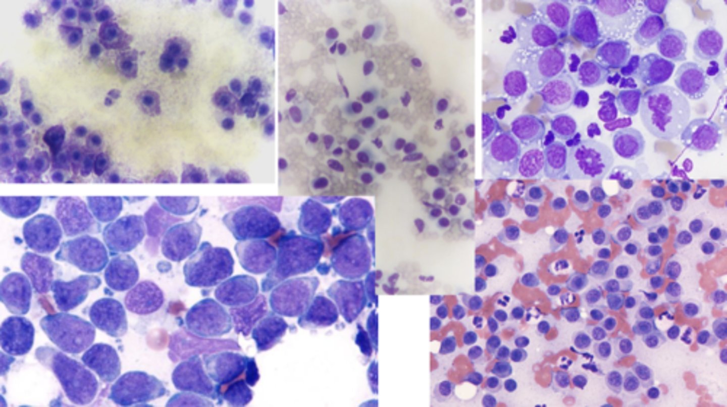 <p>What type of round cell tumor is this?</p>