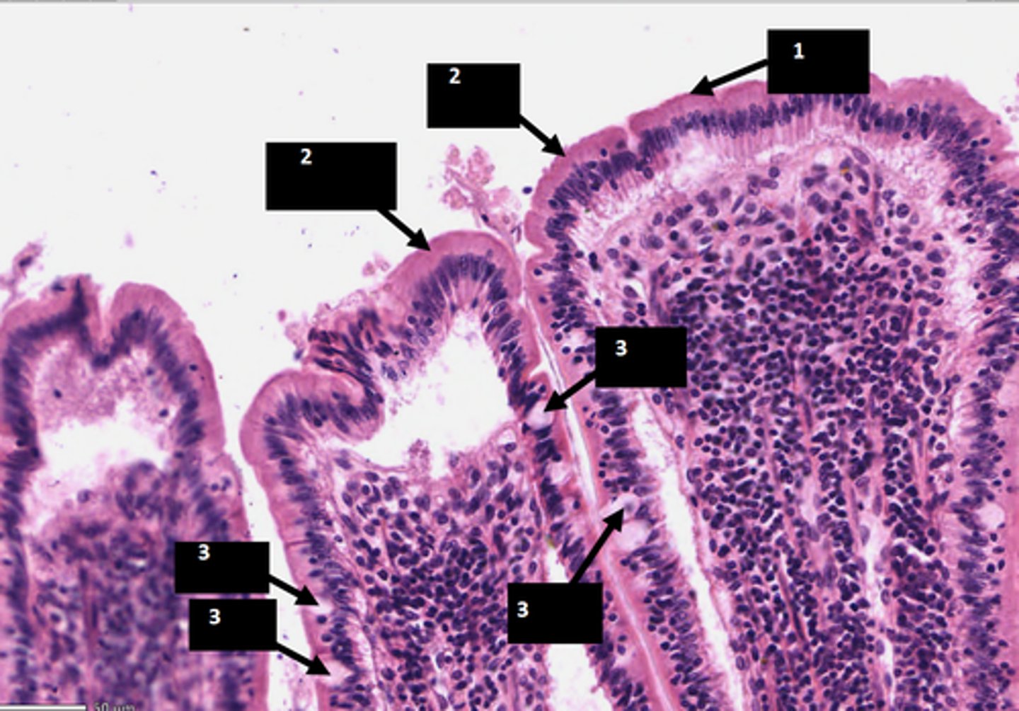 <p>name structure 3, found at the top of intestinal villi</p>