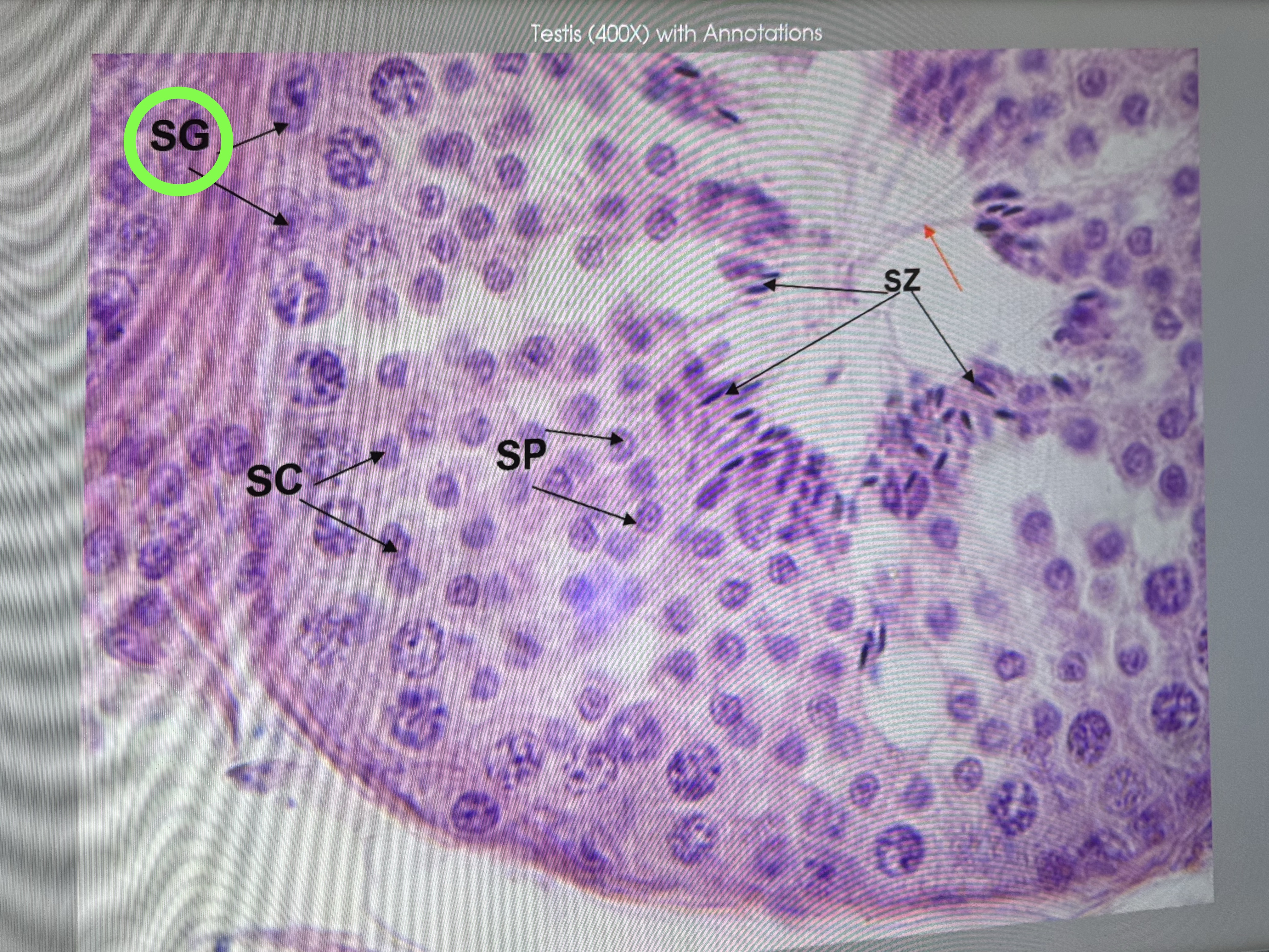 <p>What is this inside the testes </p>