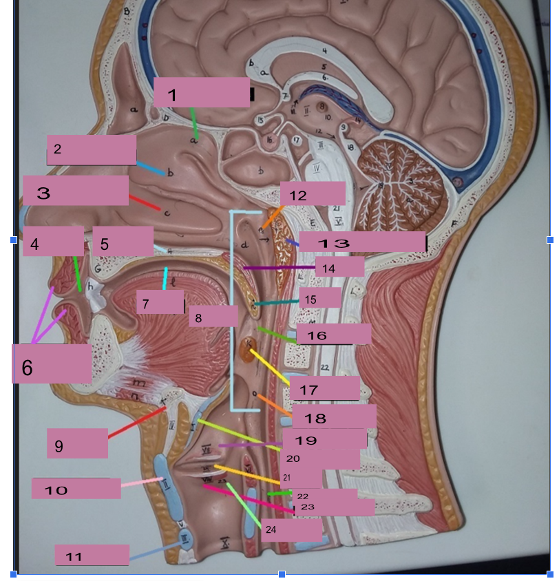 <p>What is number 23</p>