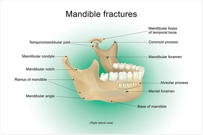 <p>Mandible</p>