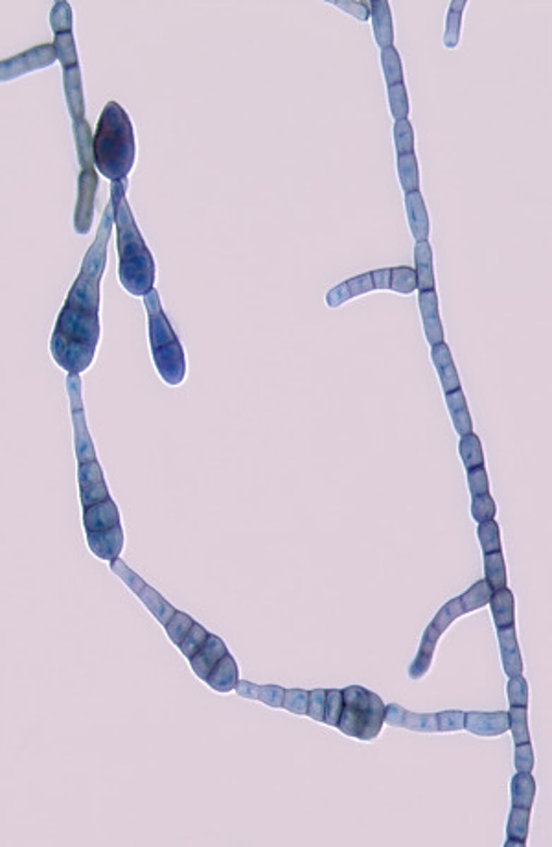<p>Alternaria spp. are dematiaceous molds that produce chains of racket-shaped muriform poroconidia.</p>