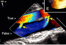 <p>What are the arrows pointing towards?</p>