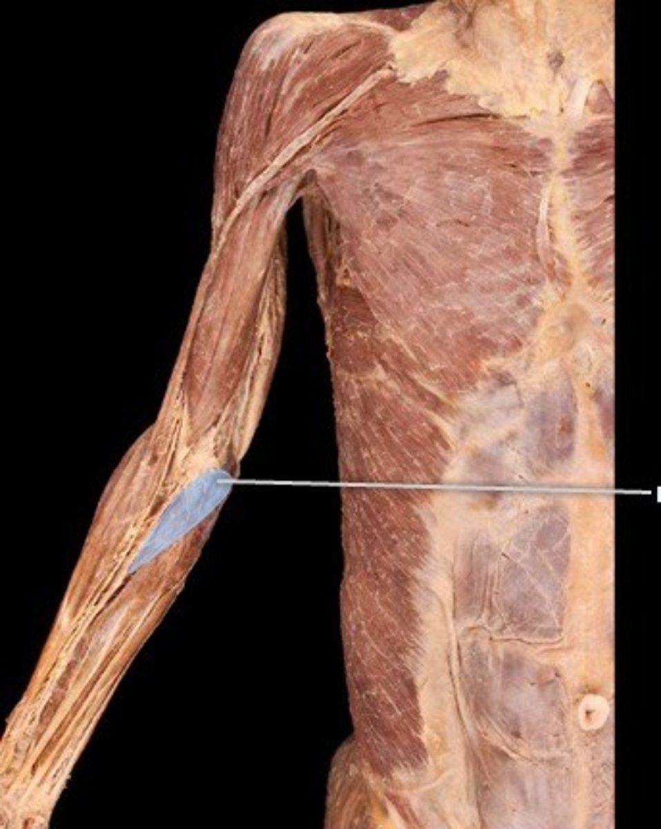 <p>What muscle is this?</p>