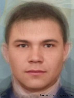 <p>Identify this Phenotype</p>