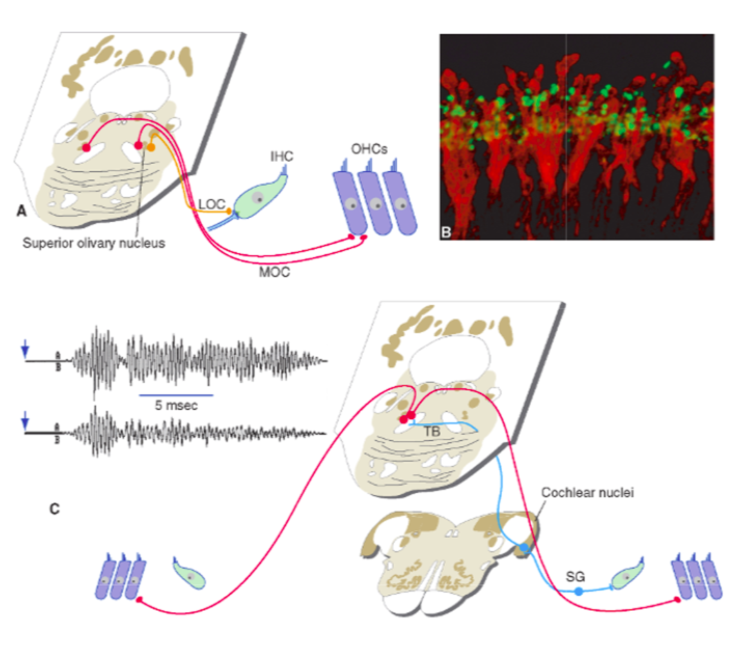 <p>middle or inner ear, NOT brain</p><p>do NOT hear person had a stroke and lost hearing in contralateral ear</p>